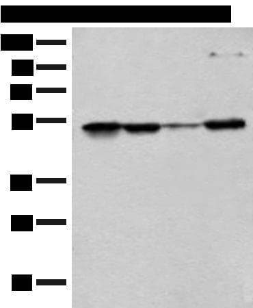 Polyclonal Rabbit anti-Human RRP1 Antibody (IHC, WB)
