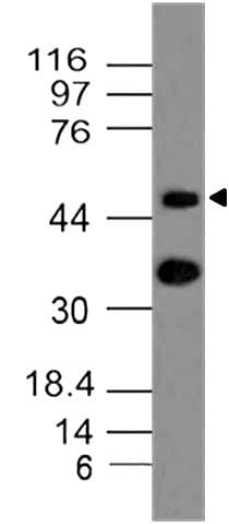 CCR6 Antibody