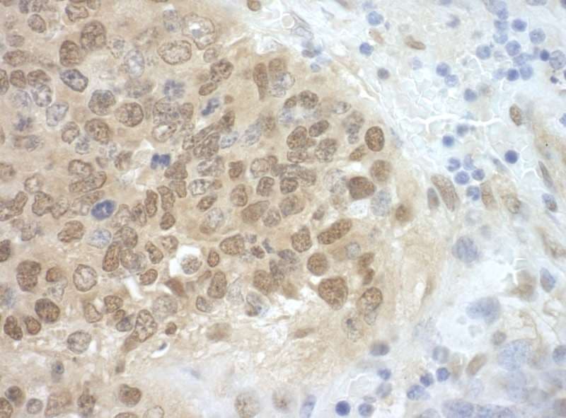 CDC6 Antibody (aa1-50)