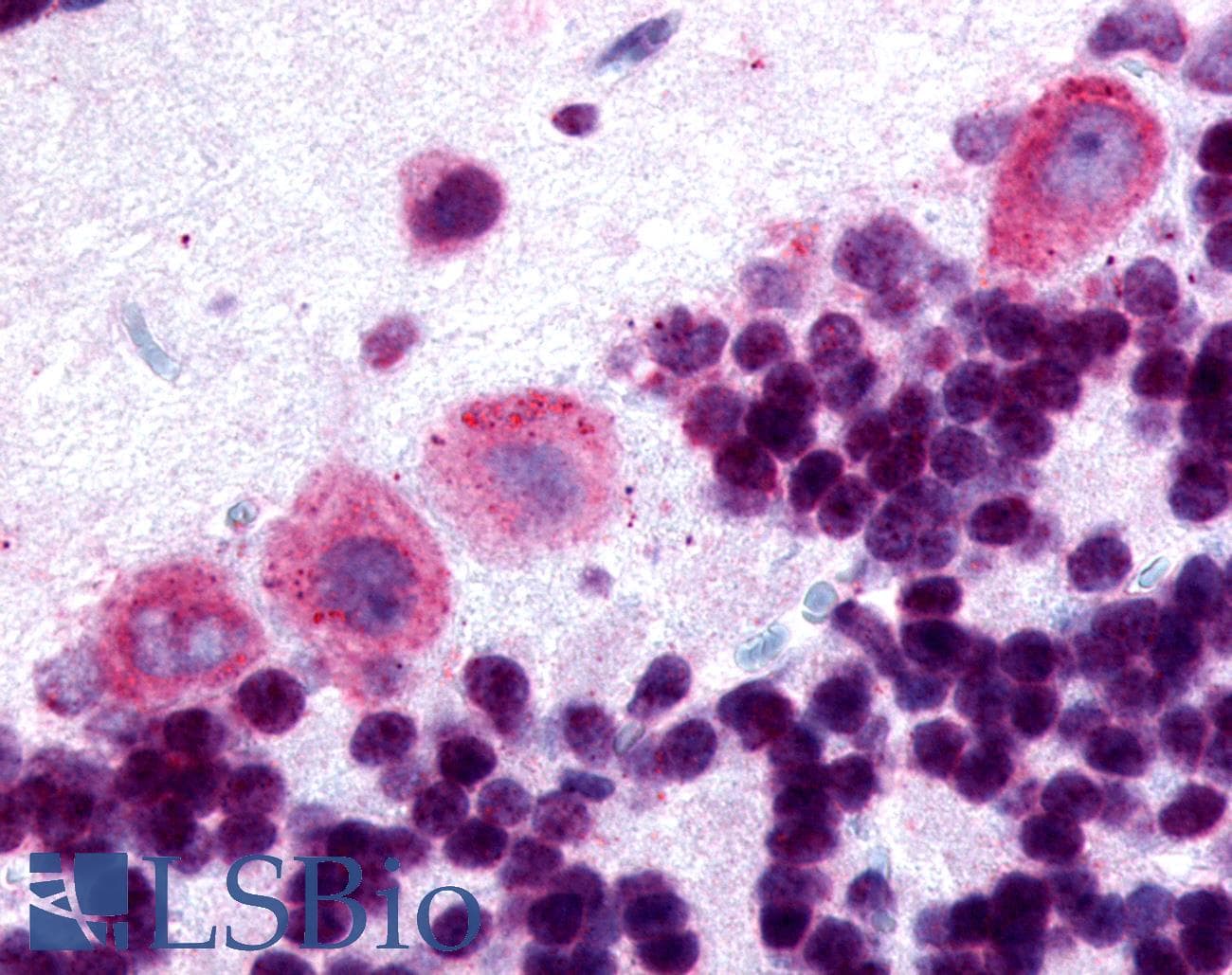 IHC-plus™ DRD5 / Dopamine Receptor D5 Antibody (Cytoplasmic Domain)