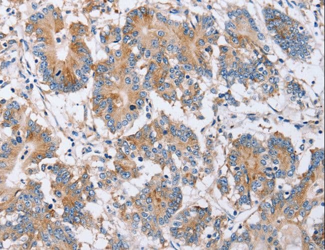 PPM1F Antibody