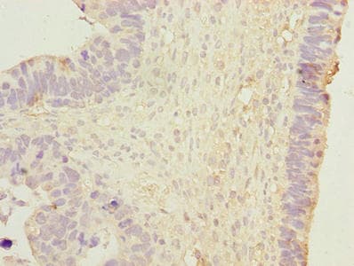 DNAJB1 / Hsp40 Antibody