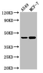 AGXT / SPT Antibody