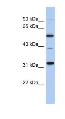 TBC1D26 Antibody (aa107-156)