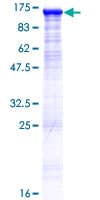Human DIS3L Protein (Recombinant GST)