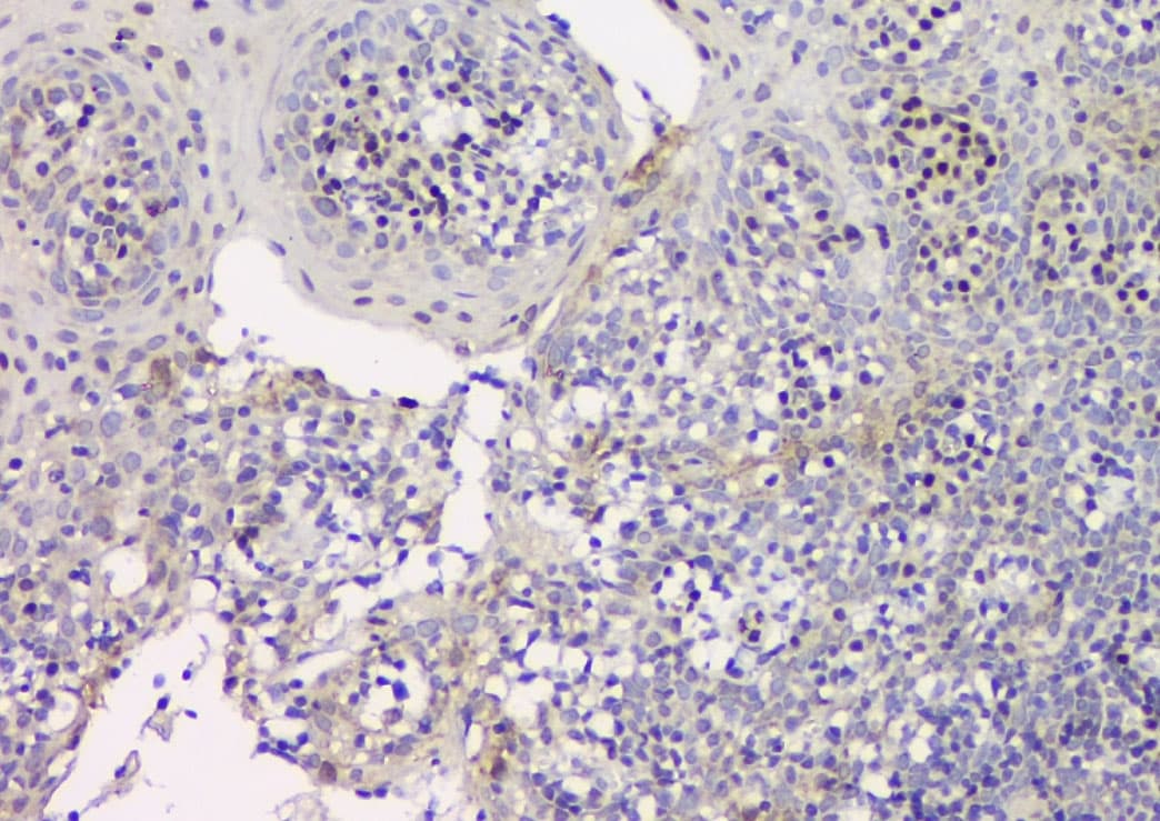 CDKN1B / p27 Kip1 Antibody (aa10-198)
