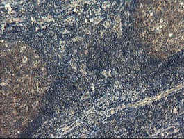 COMMD1 Antibody (clone OTI1G7)