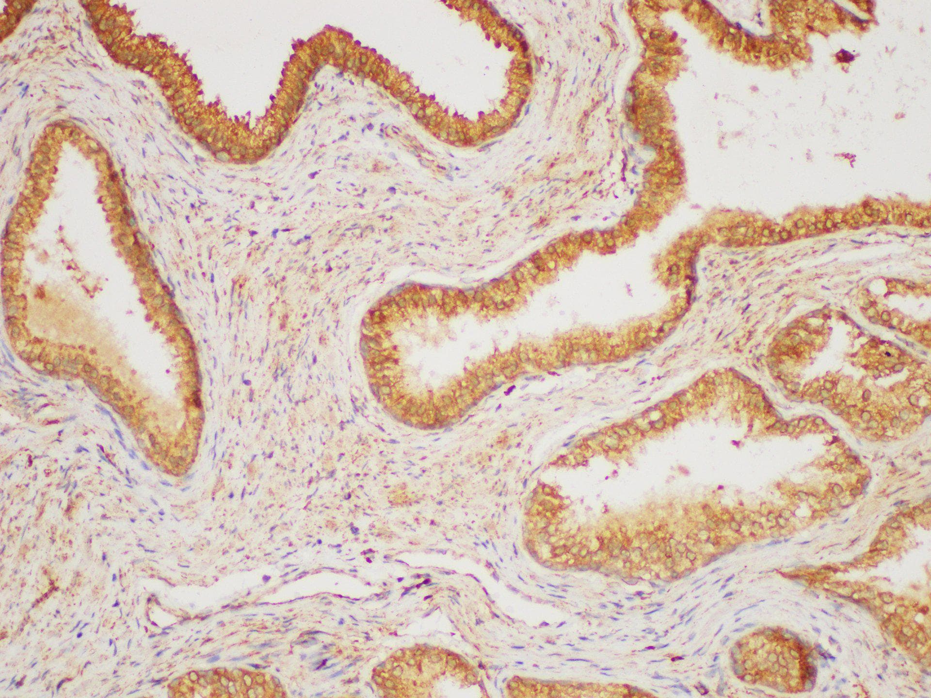 HRAS / H-Ras Antibody