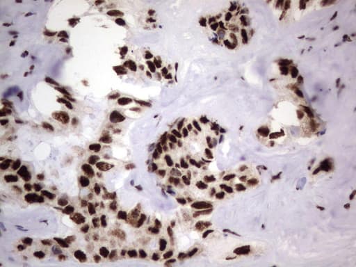 DDX56 Antibody (aa323-547, clone UMAB152)