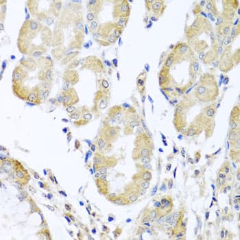 ACAD9 Antibody