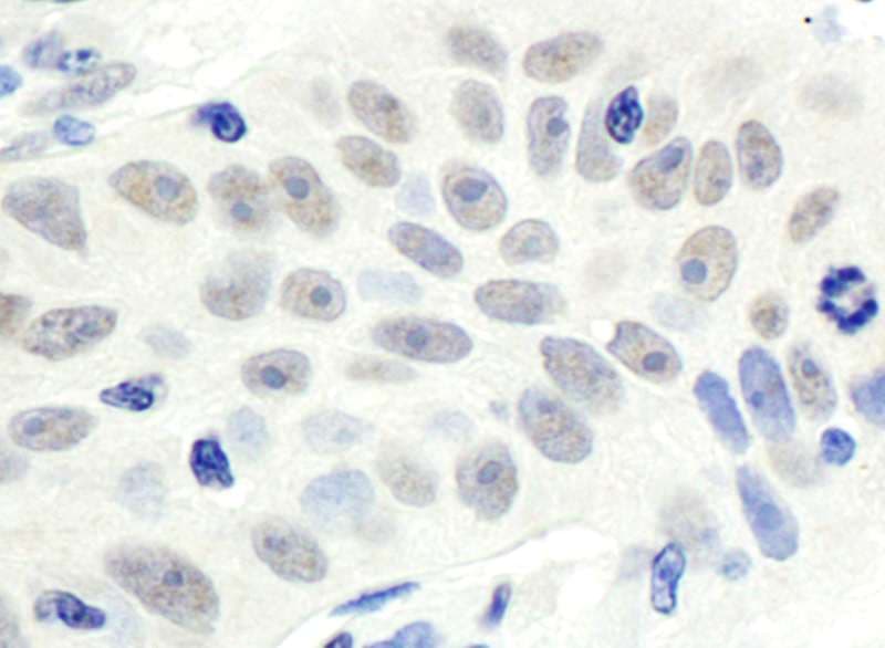 MDM4 / MDMX Antibody (aa125-175)