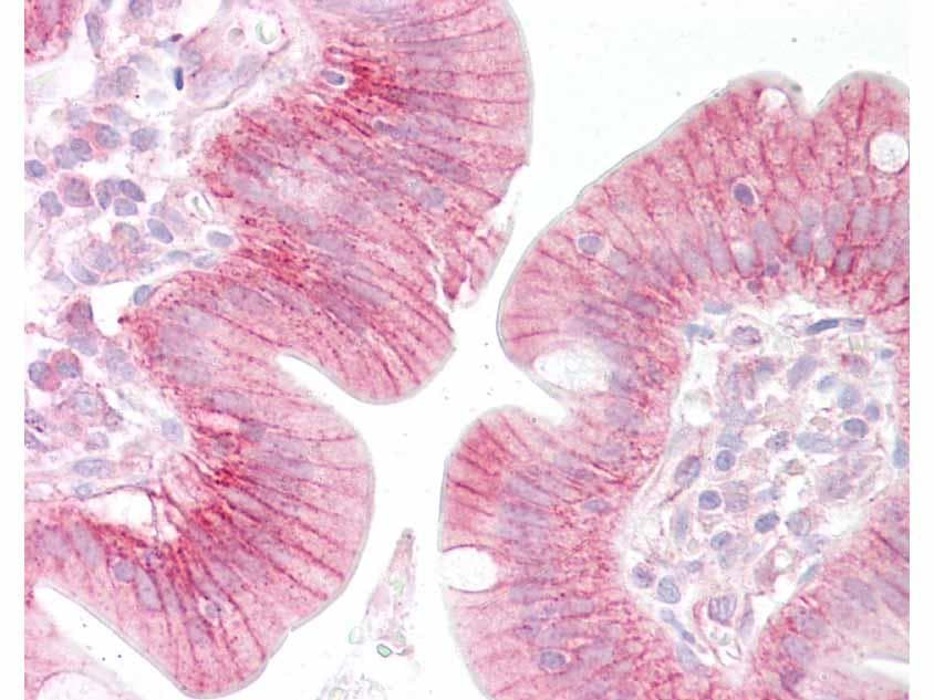 Polyclonal Rabbit anti-Human CTNNB1 / Beta Catenin Antibody (C-Terminus, IHC, WB)