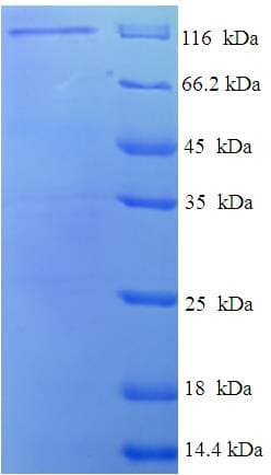 Rat DLG3 / SAP102 Protein (Recombinant GST)