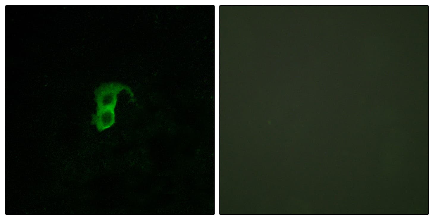 GPR87 Antibody
