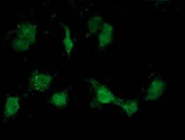 ATP6V1B1 Antibody (clone OTI1H6)