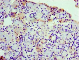 RPL30 / Ribosomal Protein L30 Antibody