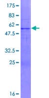 Human FBXO44 Protein (Recombinant GST)