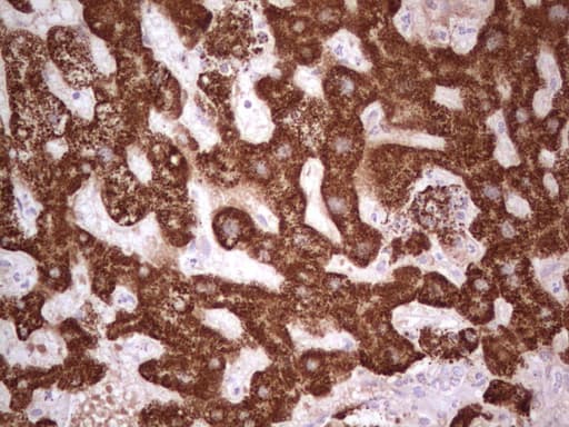 ABAT Antibody (aa29-323, clone OTI3F6, Carrier-free)