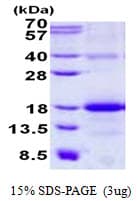 Human CLEC2B / AICL Protein (Recombinant His)
