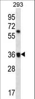 Polyclonal Rabbit anti-Human OR52E2 Antibody (aa296-324, WB)