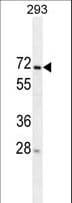 Monoclonal Mouse anti-Human MIPEP Antibody (WB)