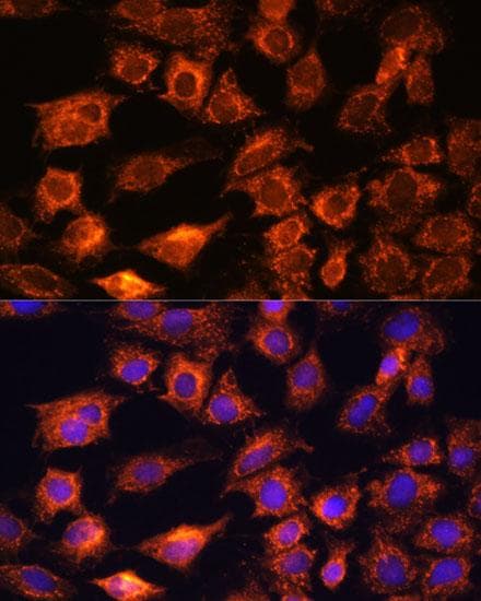 Polyclonal Rabbit anti-Human PTCD1 Antibody (IF)
