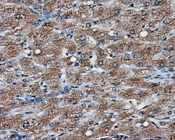 NPR3 Antibody (clone OTI11A6)