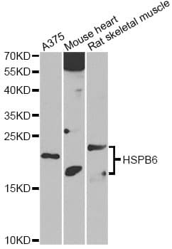Polyclonal Rabbit anti-Human HSPB6 / HSP20 Antibody (WB)