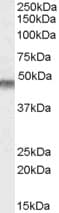 IHC-plus™ KCNJ11 / Kir6.2 Antibody (aa18-30)