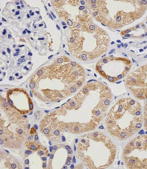 VWF / Von Willebrand Factor Antibody (clone 907CT12.1.9)