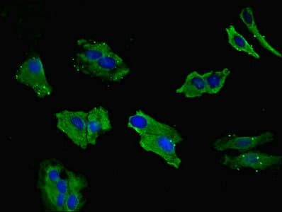Polyclonal Rabbit anti-Human LIMS1 / PINCH Antibody (IHC, IF)