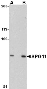 IHC-plus™ Polyclonal Rabbit anti-Human KIAA1840 / SPG11 Antibody (IHC, WB)