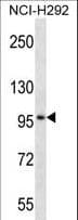 Polyclonal Rabbit anti-Human TRIM1 / MID2 Antibody (aa690-717, IHC, WB)