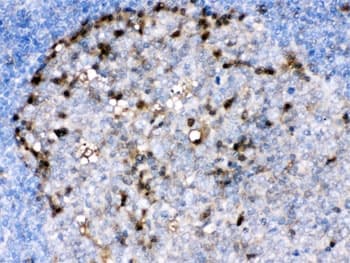 Polyclonal Rabbit anti-Human ADA / Adenosine Deaminase Antibody (IHC, WB)
