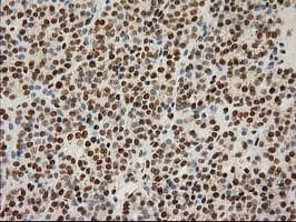 LOX / Lysyl Oxidase Antibody (clone OTI9G2)