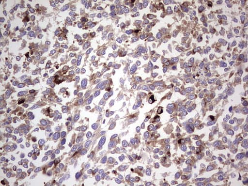 Monoclonal Mouse anti-Human CD63 Antibody (clone OTI7F1, IHC)