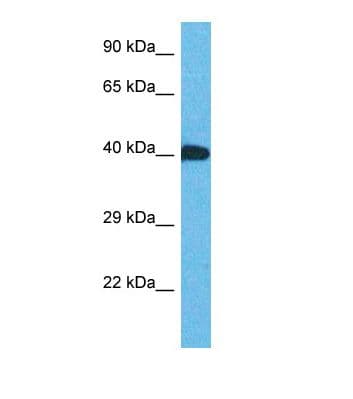 Polyclonal Rabbit anti-Human ZNF883 Antibody (C-Terminus, WB)