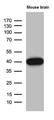 Monoclonal Mouse anti-Human SEPT3 / Septin 3 Antibody (clone OTI3C8, IHC, WB)