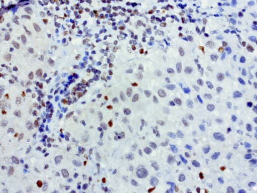 MEF2C Antibody (clone UMAB17)
