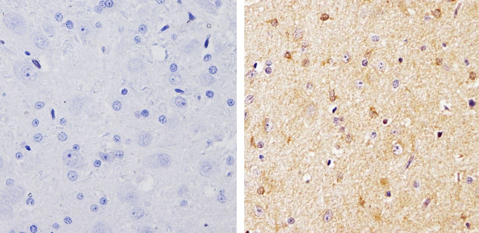 Polyclonal Rabbit anti-Human ARRB1 + ARRB2 Antibody (IHC, WB)