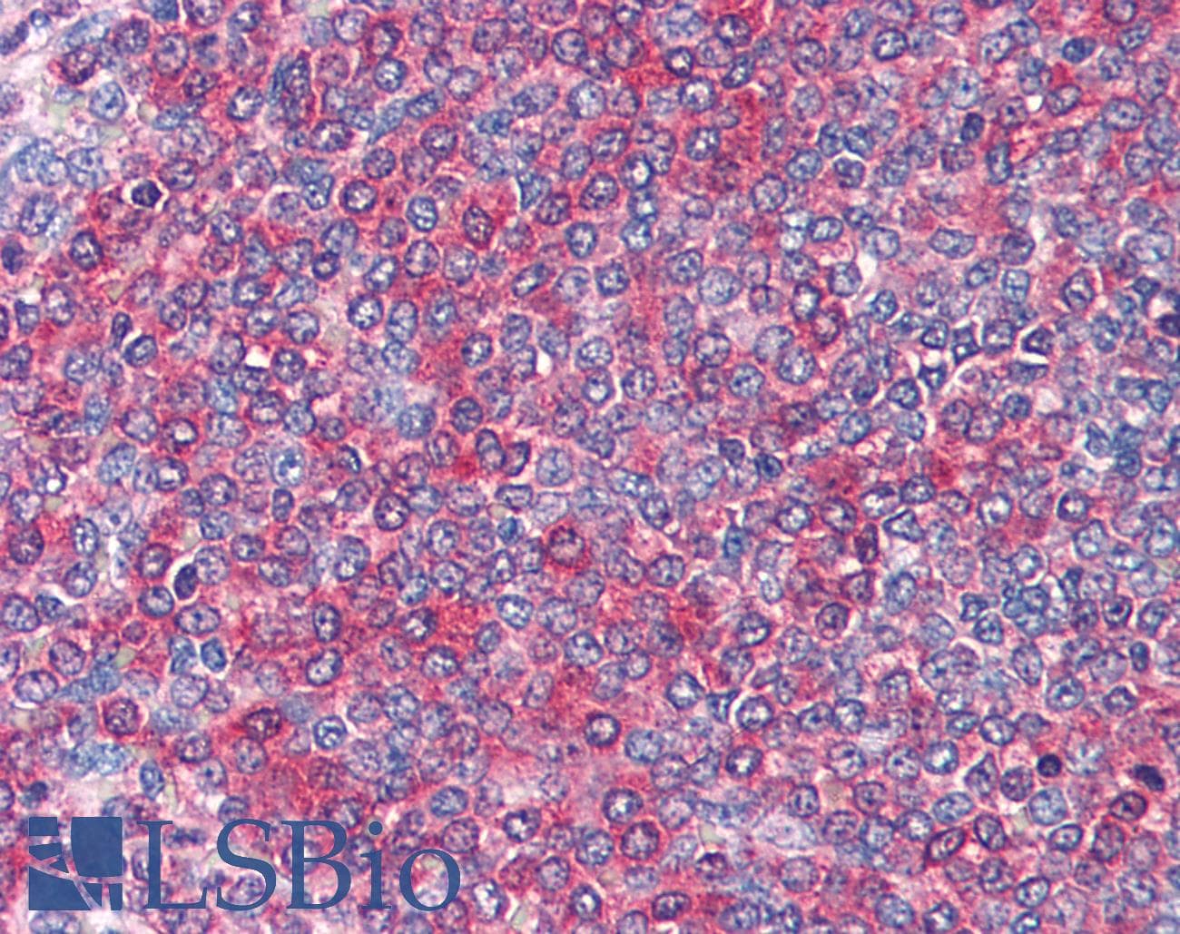 IHC-plus™ FZD7 / Frizzled 7 Antibody (aa559-572)