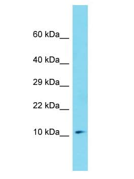 Polyclonal Rabbit anti-Human MZT1 Antibody (aa28-77, WB)