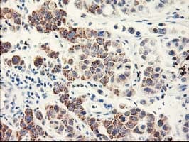 EIF2B3 Antibody (clone OTI3H3)