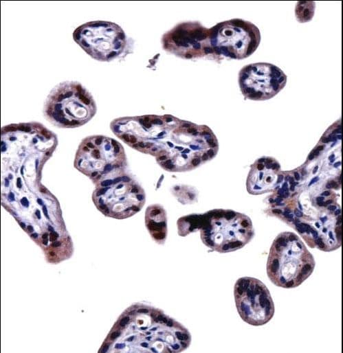 SOCS6 / SOCS-6 Antibody (aa40-69)