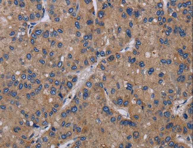 PVRL4 / Nectin 4 Antibody