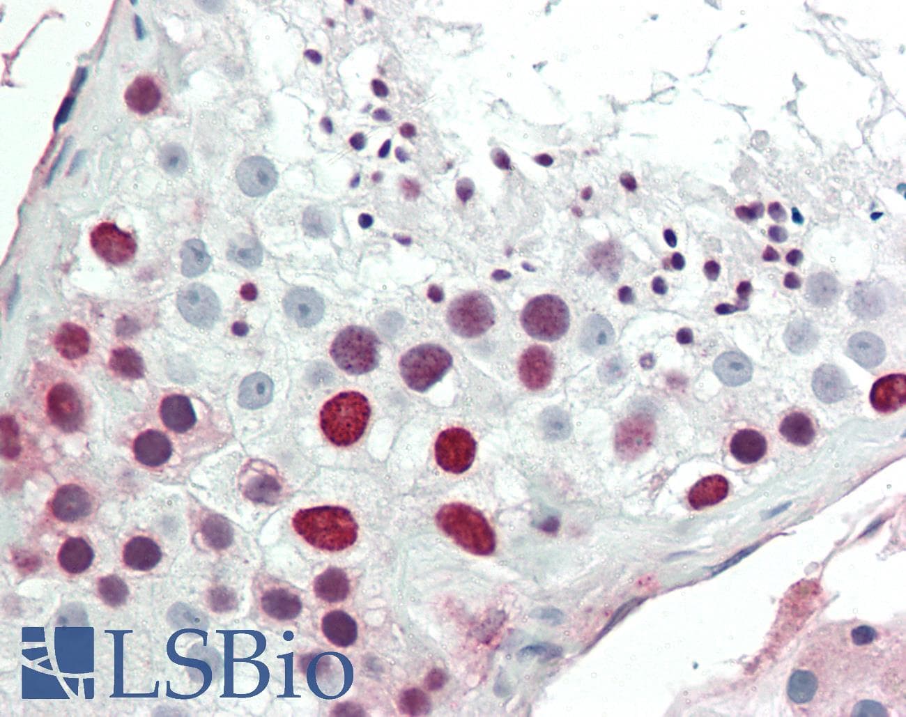 IHC-plus™ HMGIY / HMGA1 Antibody (aa1-53)