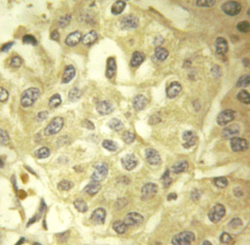 p66 / SHC Antibody