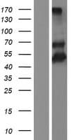 TIMD4 / TIM4 / TIM-4 Protein (Over-Expression Lysate Myc-DDK (Flag))