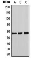 TH / Tyrosine Hydroxylase Antibody (N-Terminus)