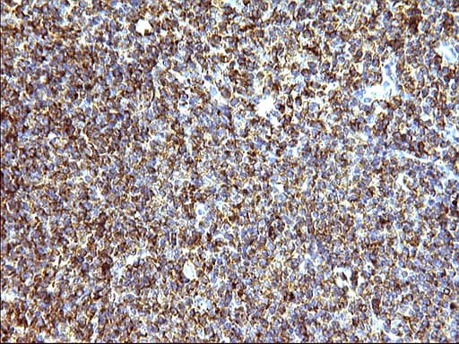 Monoclonal Mouse anti-Human SCAMP2 Antibody (clone OTI1H10, IHC, WB)